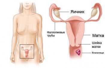 рак влагалища